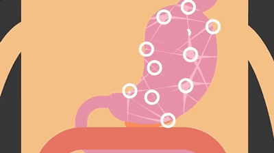 cell:原来饱腹感信息是伸展的肠道告诉我们的!